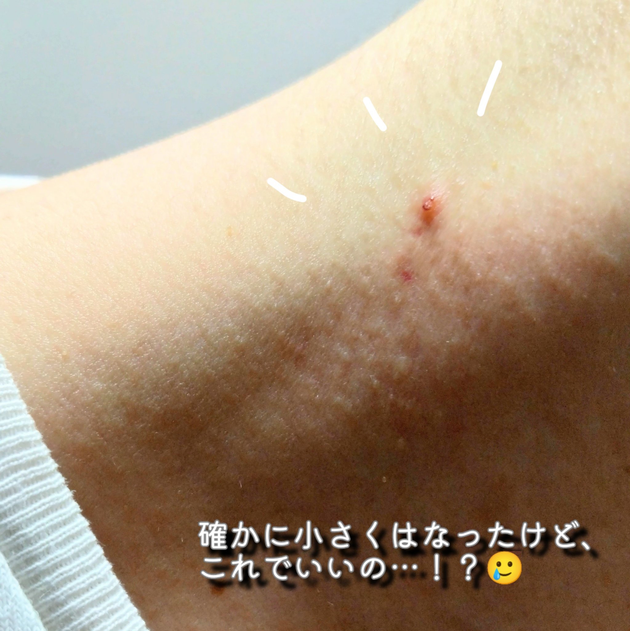 つぶぽろり/cosparade/ネック・デコルテケアを使ったクチコミ（3枚目）