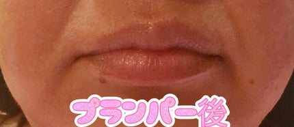 SHEGLAMプランパーアディクトホット&クールデュオ/SHEGLAM/リッププランパーを使ったクチコミ(6枚目)