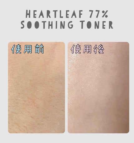 ドクダミ 77 スージングトナー/Anua/化粧水を使ったクチコミ(2枚目)