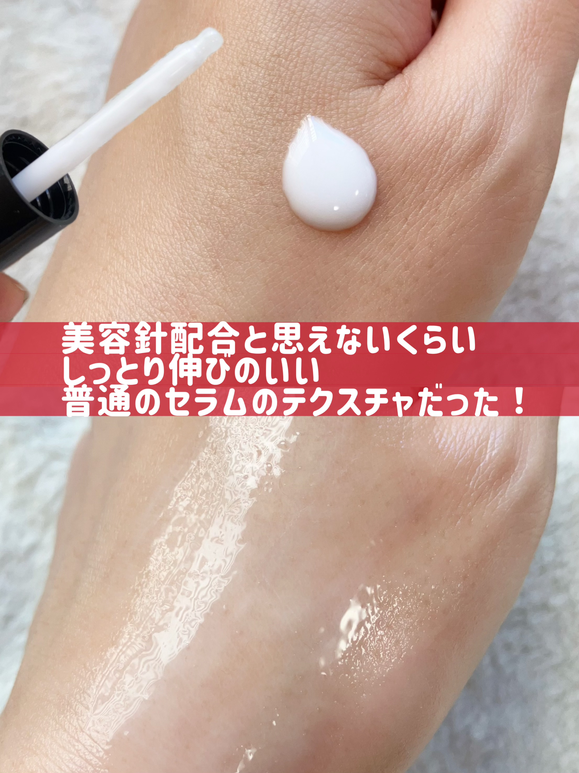 リードルS PDRN+ セラム/VT/美容液を使ったクチコミ（2枚目）
