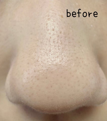 チャコット・コスメティクス ラスティングベースのクチコミ「チャコット ラスティングベース 550 ナチュラル
――――――――――――――――――
【崩.....」(1枚目)