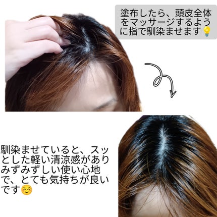 薬用 メディカル アンチヘアロスセラム/L'OCCITANE/頭皮ローションを使ったクチコミ(5枚目)