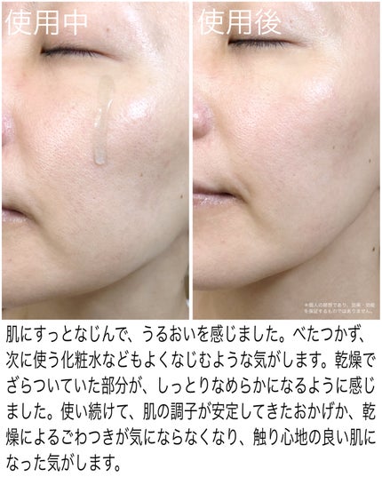 SOOTHE FORTE SERUM/essenciel/ブースター・導入液を使ったクチコミ(3枚目)