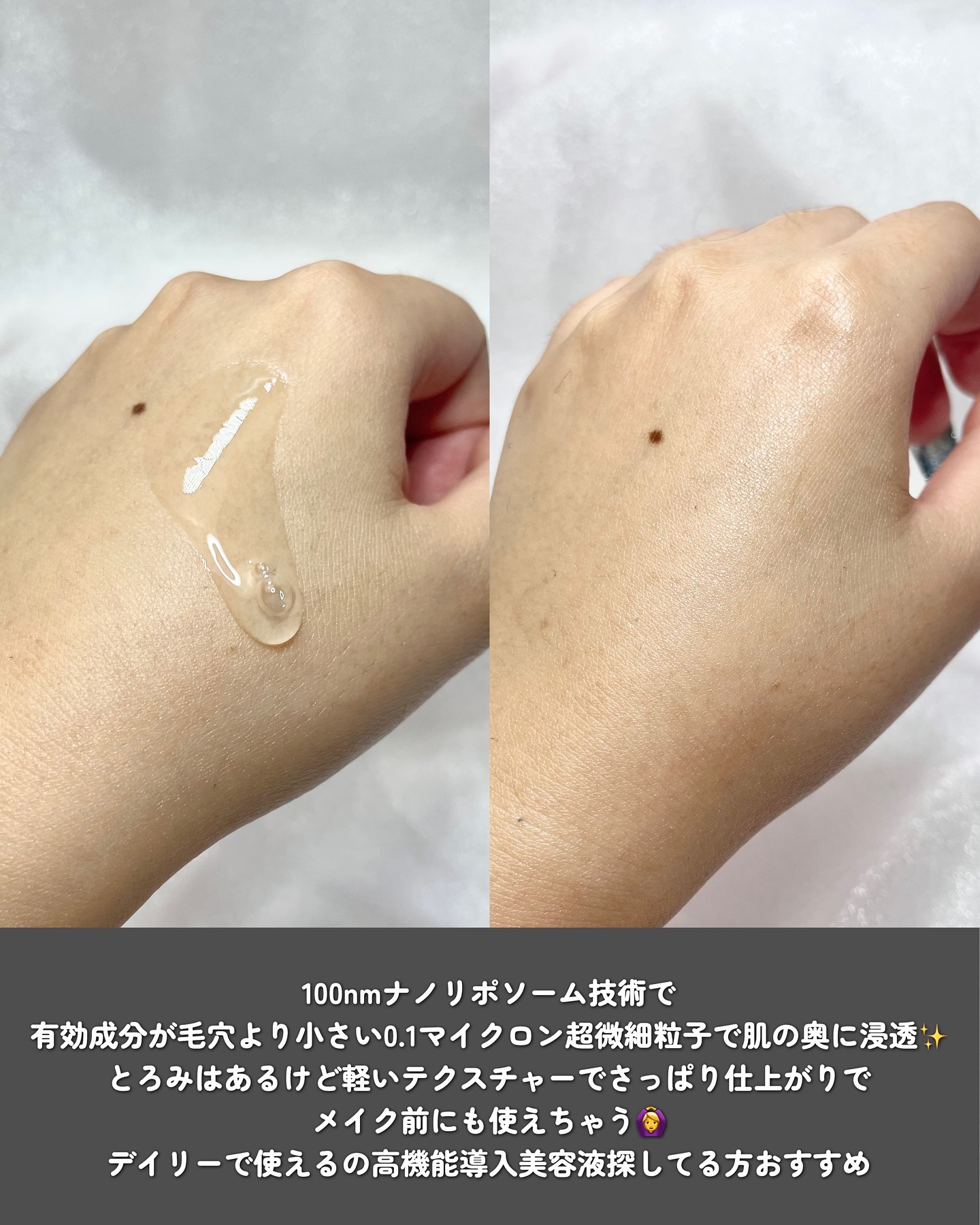 スキンブースティングフォルテセラム/essenciel/美容液を使ったクチコミ（3枚目）