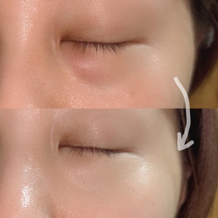 ディセンシア ハイカバーフィット コンシーラー/DECENCIA/リキッドコンシーラーを使ったクチコミ(4枚目)