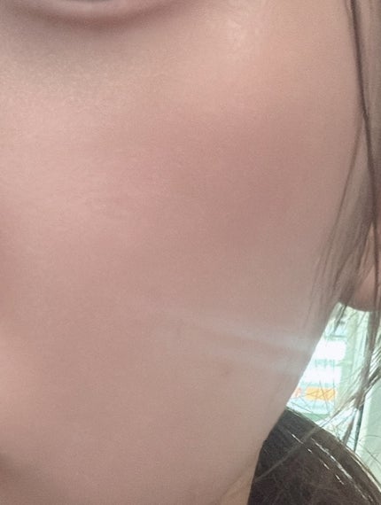 スキンブースティングフォルテセラム/essenciel/美容液を使ったクチコミ(6枚目)