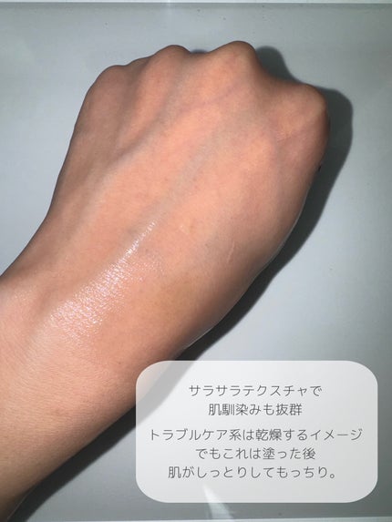 AZアゼライン酸15セラム/コスデバハ/美容液を使ったクチコミ(3枚目)