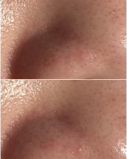 NI【韓国コスメオタク】 on LIPS 「⌇Parnell︎▶︎シカマヌセラムクッションファンデ 23号..」(6枚目)