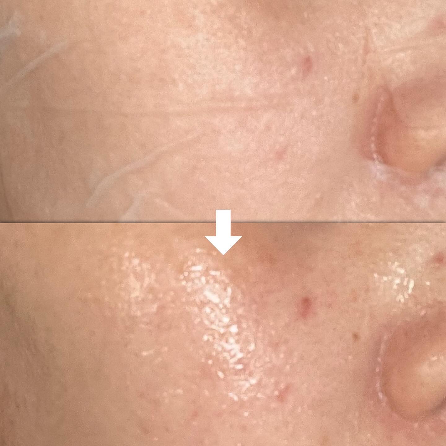 スキンブースターマスクモイスチャー/BANOBAGI/シートマスク・パックを使ったクチコミ（3枚目）