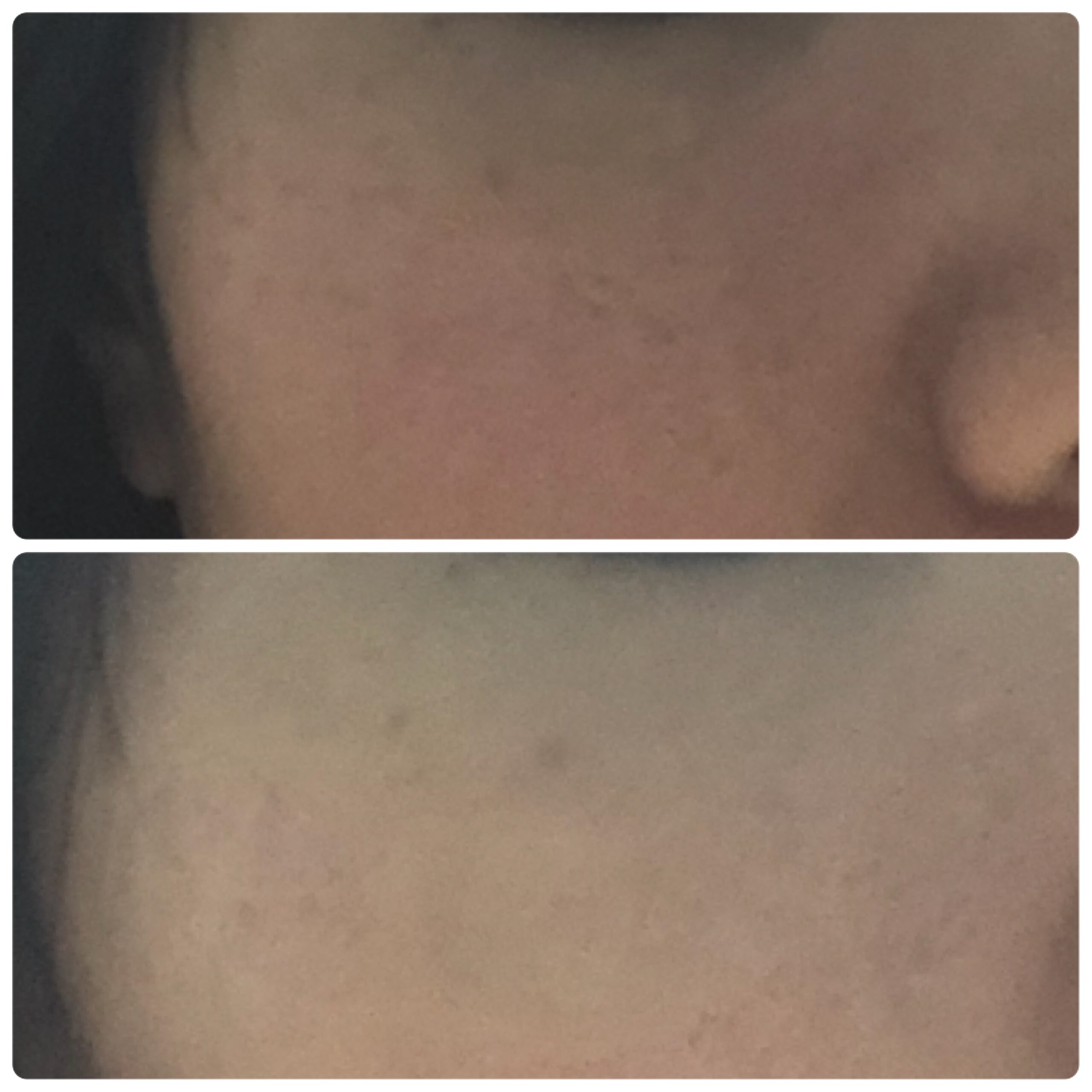 ディセンシア ハイカバーフィット コンシーラー/DECENCIA/リキッドコンシーラーを使ったクチコミ（3枚目）