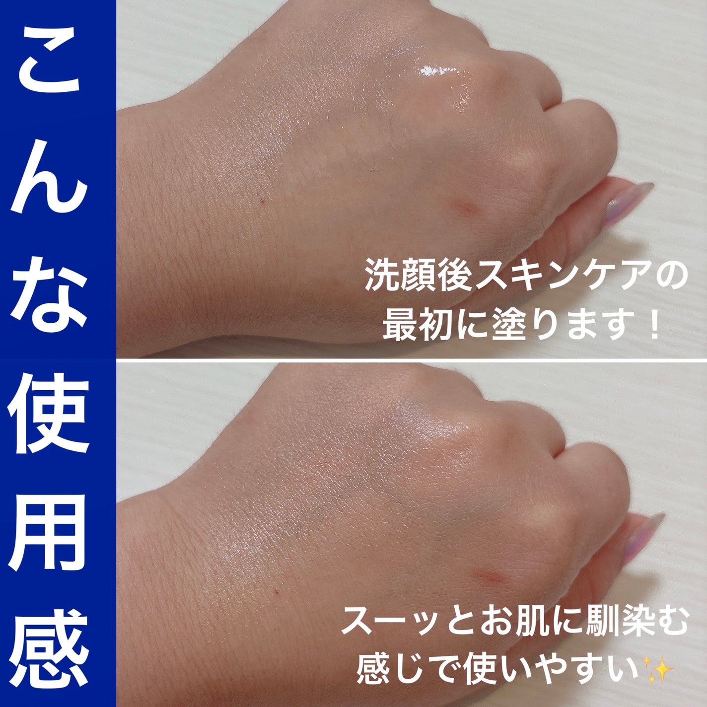 タカミスキンピール/タカミ/ブースター・導入液を使ったクチコミ(4枚目)