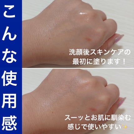 タカミスキンピール/タカミ/ブースター・導入液を使ったクチコミ(4枚目)