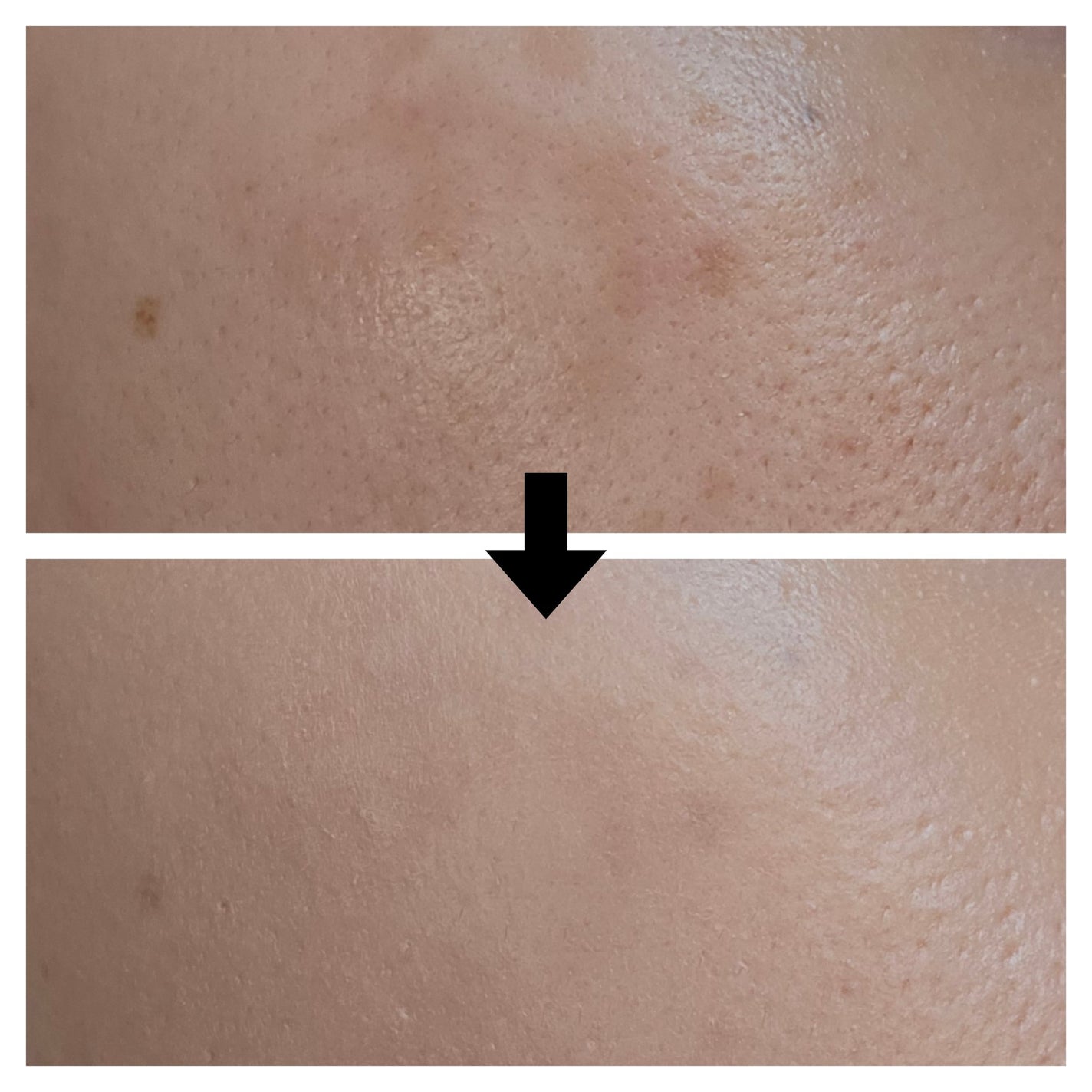 ディセンシア ハイカバーフィット コンシーラー/DECENCIA/リキッドコンシーラーを使ったクチコミ(4枚目)