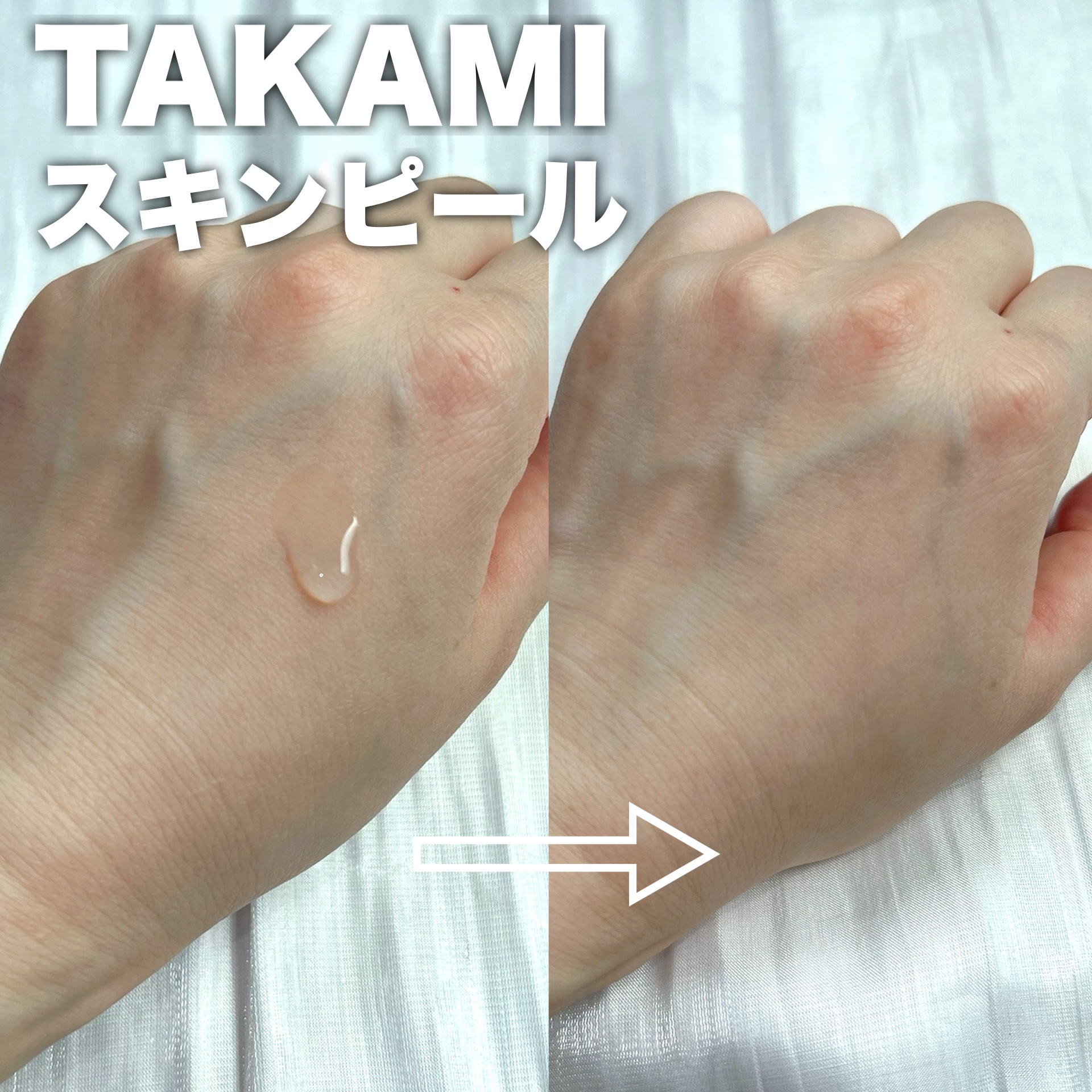 タカミスキンピール/タカミ/ブースター・導入液を使ったクチコミ（3枚目）