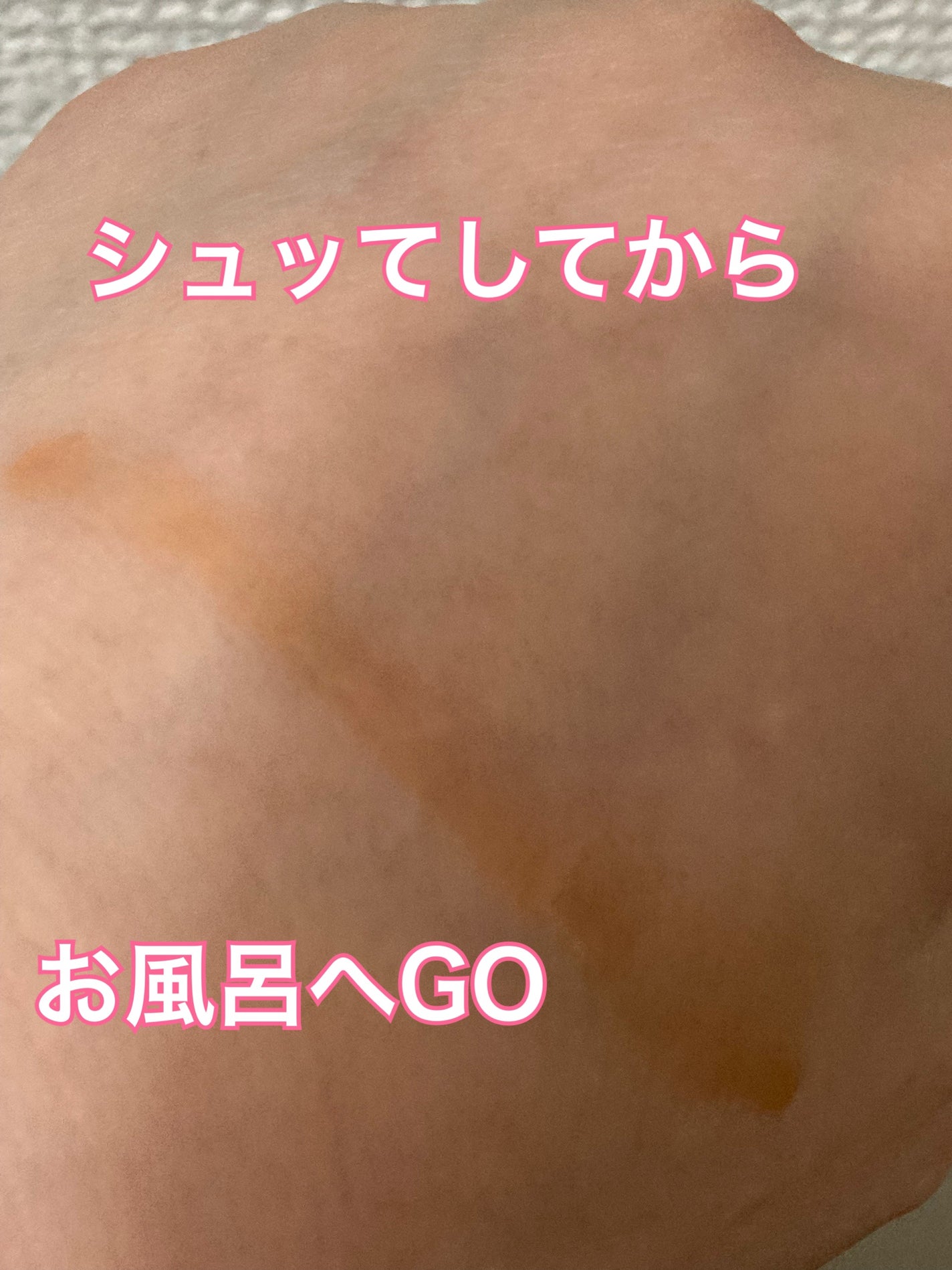 レッドアクネ ボディピーリングショット/MEDICUBE/ピーリングを使ったクチコミ(4枚目)