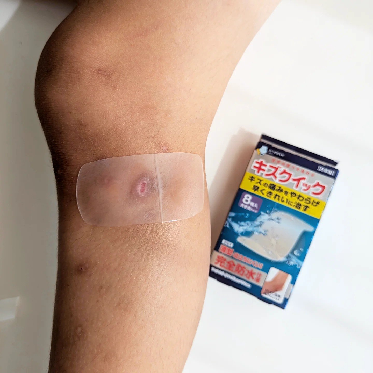 キズクイック/東洋化学/その他を使ったクチコミ（3枚目）