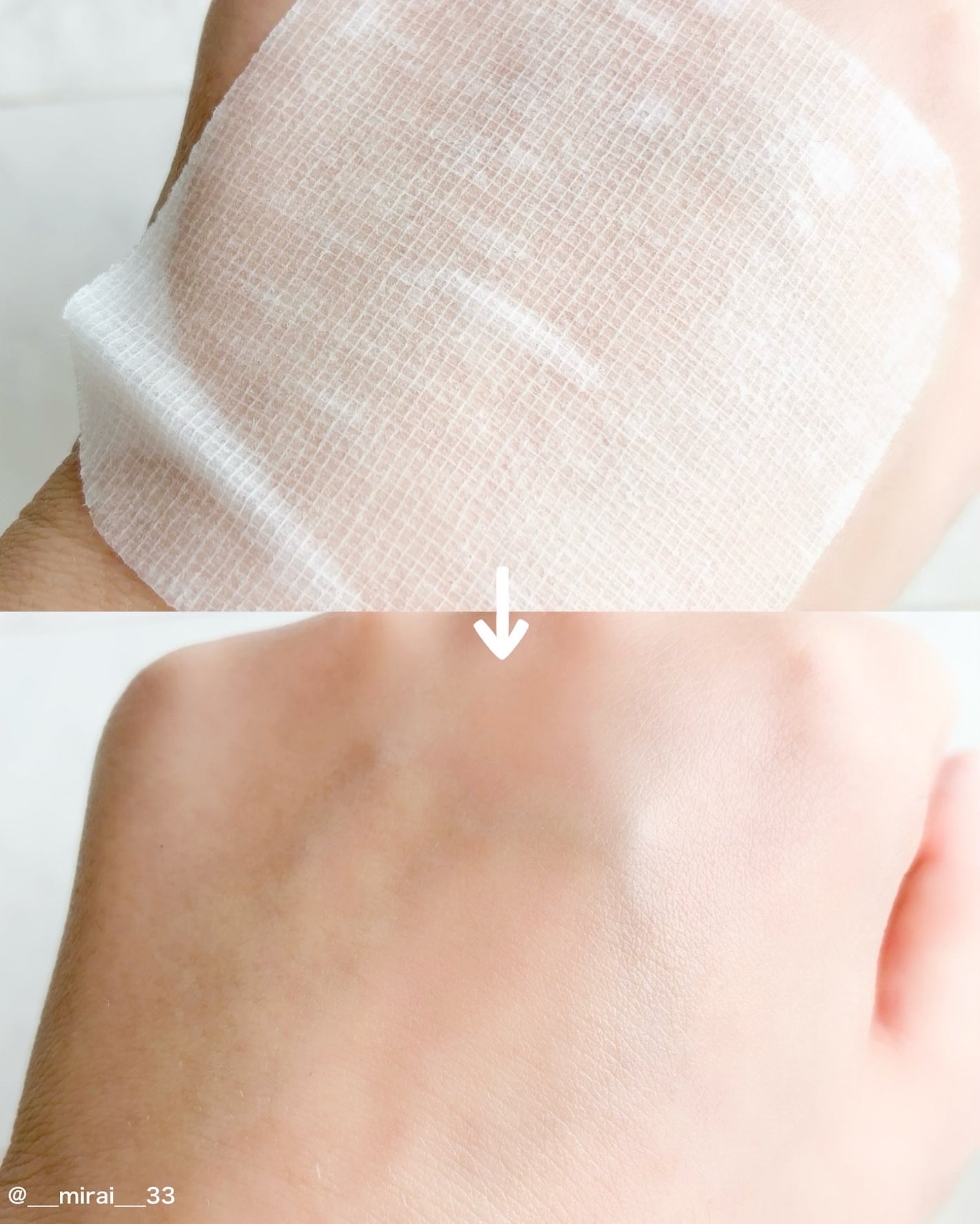 ティーツリー トラブルパッド/MEDIHEAL/トナーパッドを使ったクチコミ(3枚目)