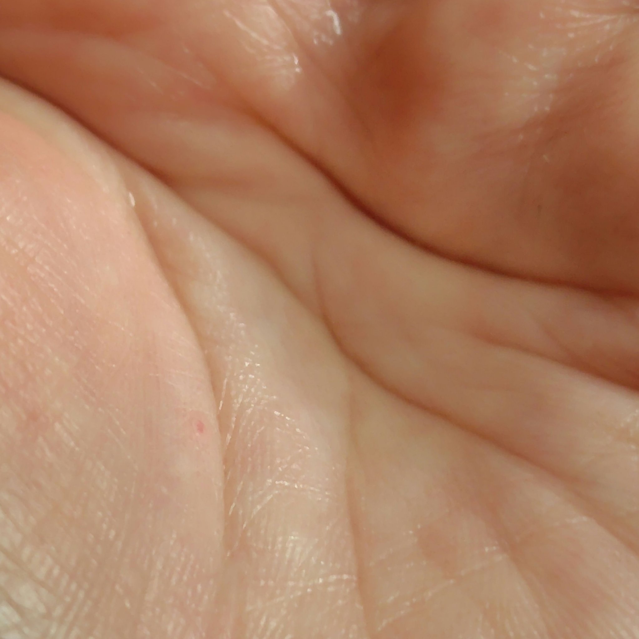 ローションイドロA n/クレ・ド・ポー ボーテ/化粧水を使ったクチコミ（3枚目）