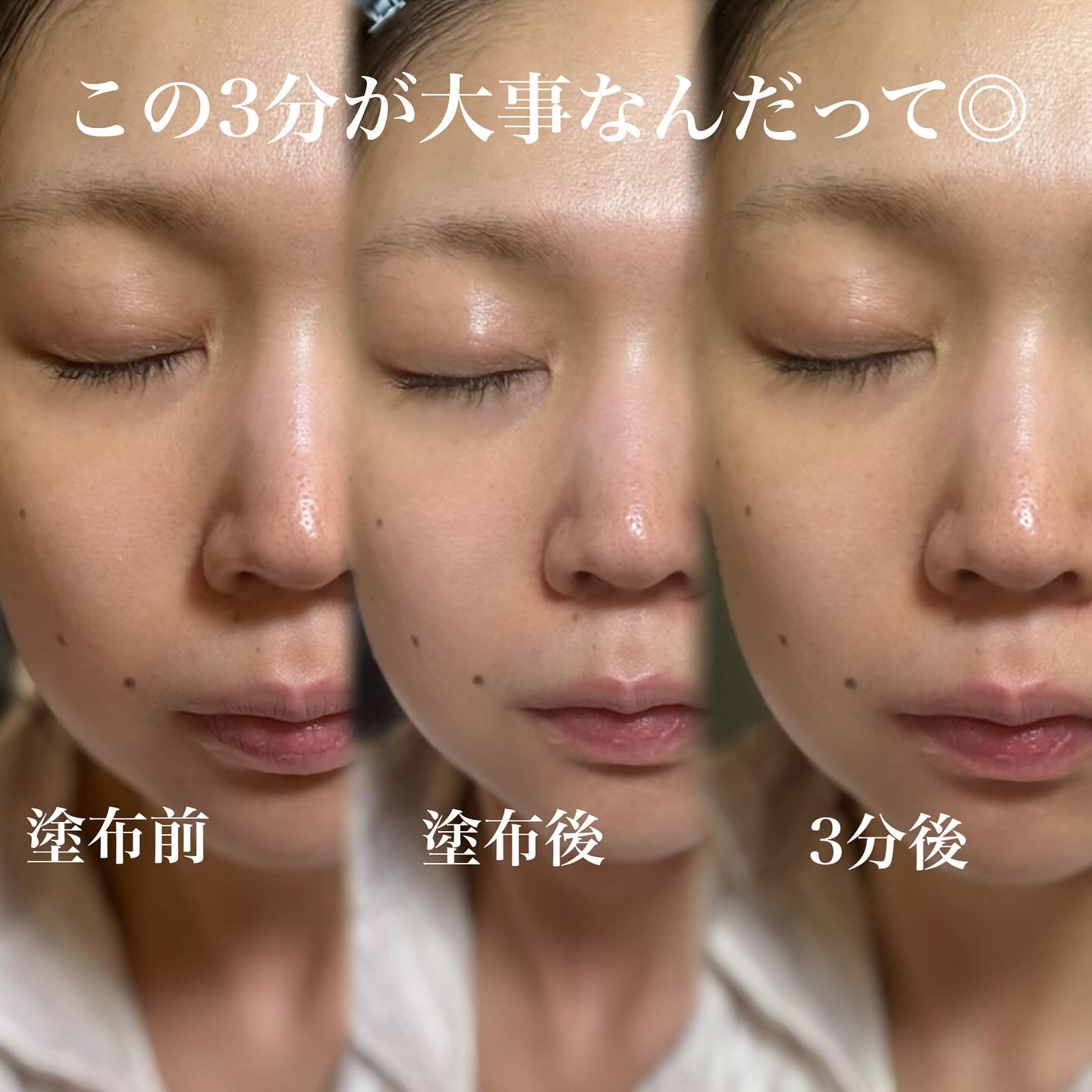 タカミスキンピール/タカミ/ブースター・導入液を使ったクチコミ（3枚目）