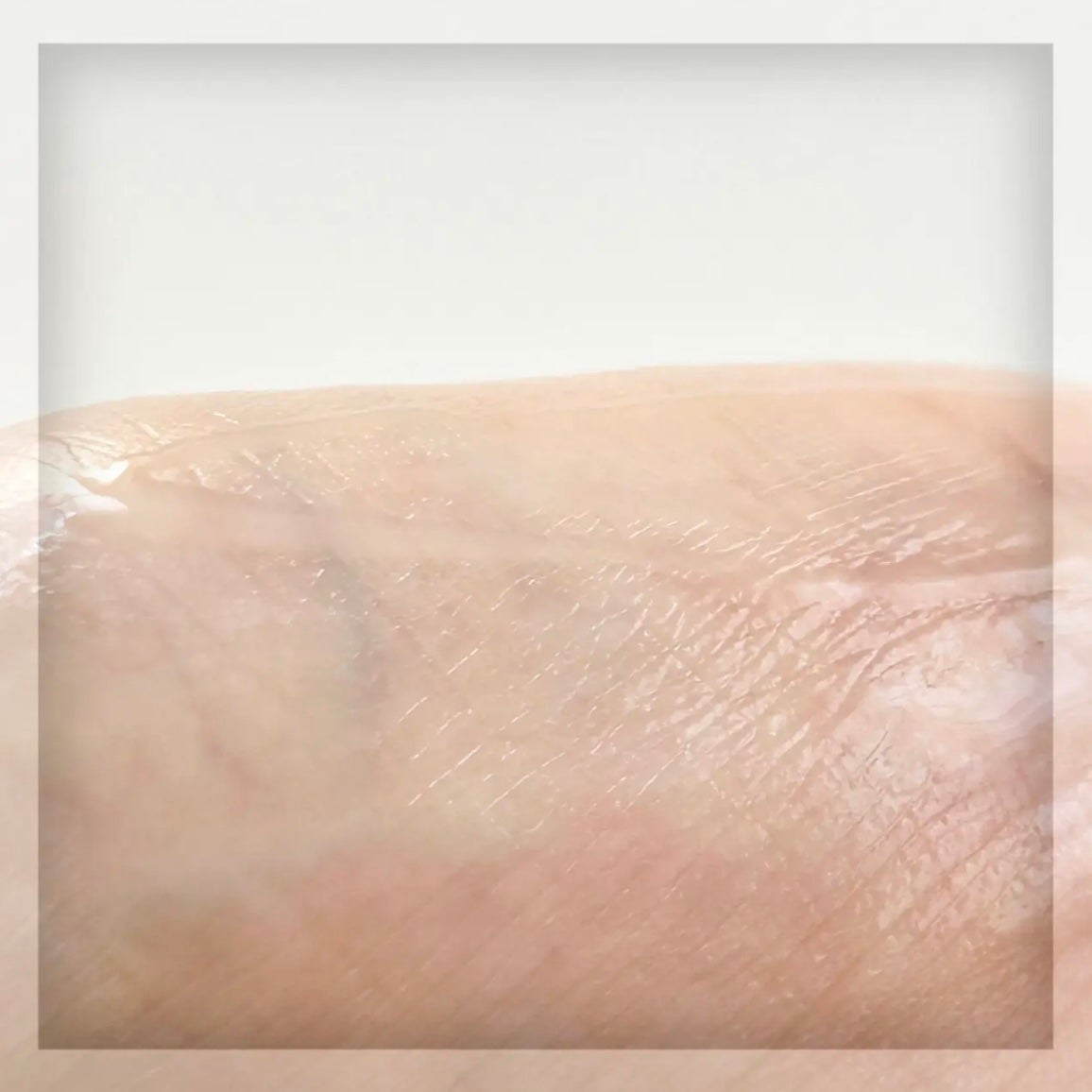 リデンス チェリートーン&スポットコレクターアンプル/redence/美容液を使ったクチコミ(5枚目)