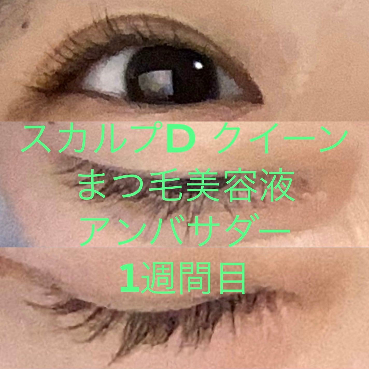 スカルプDまつ毛美容液 クイーン/アンファー(スカルプD)/まつげ美容液を使ったクチコミ(1枚目)