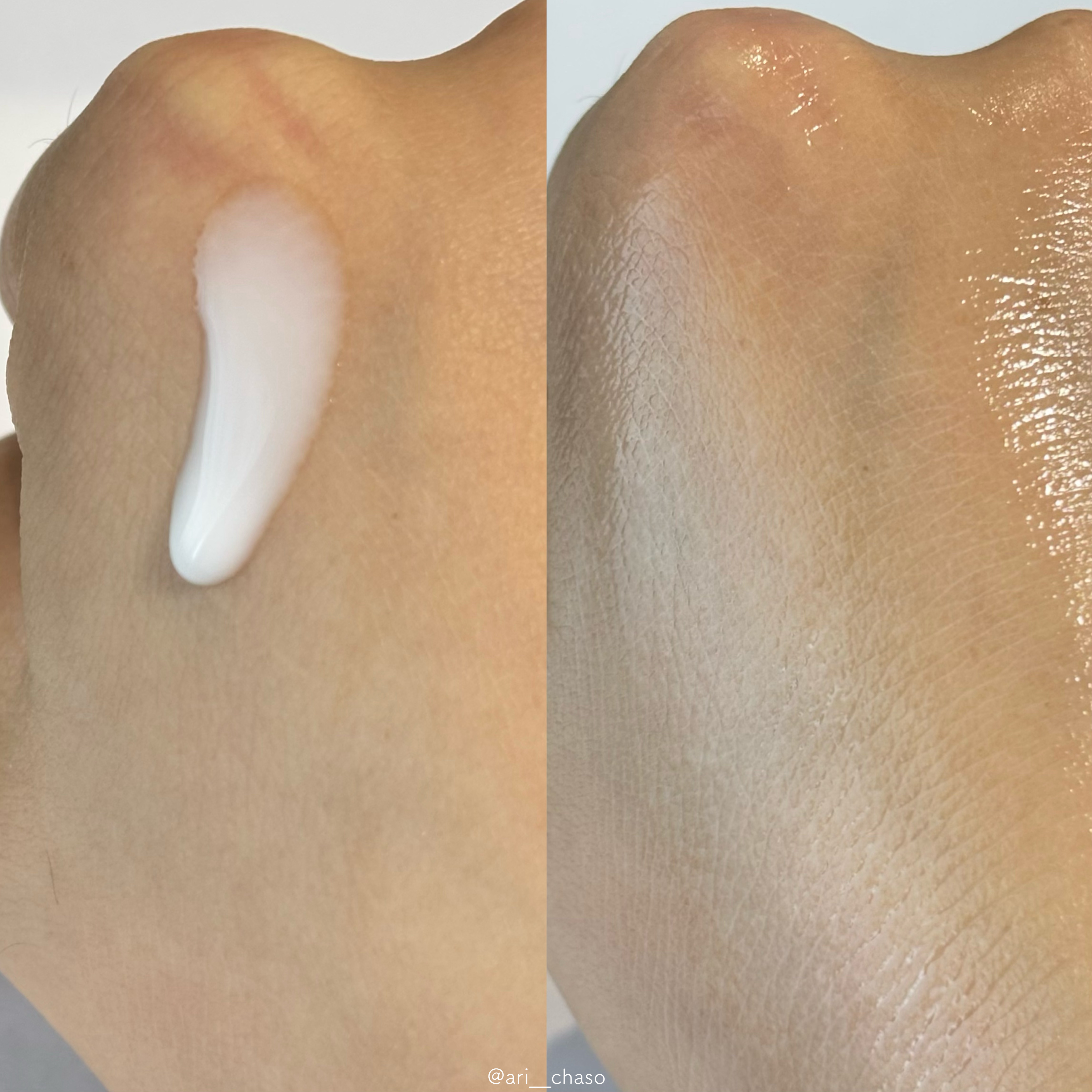 リードルS PDRN+ セラム/VT/美容液を使ったクチコミ（3枚目）