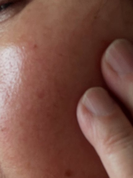 PDRN 1000 Plus Cream/Rejuveon/フェイスクリームを使ったクチコミ(4枚目)