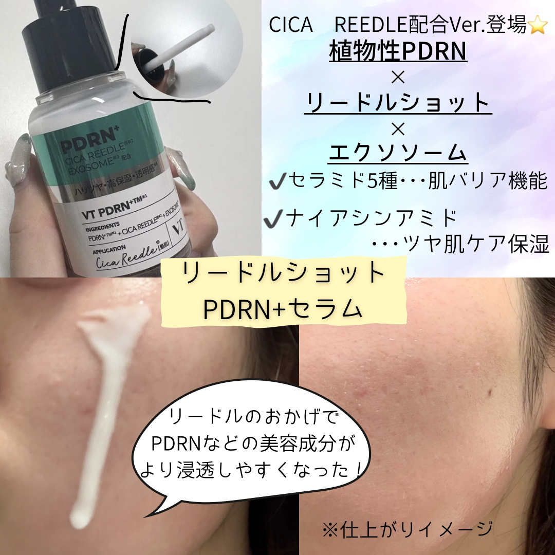 リードルS PDRN+ セラム/VT/美容液を使ったクチコミ（2枚目）