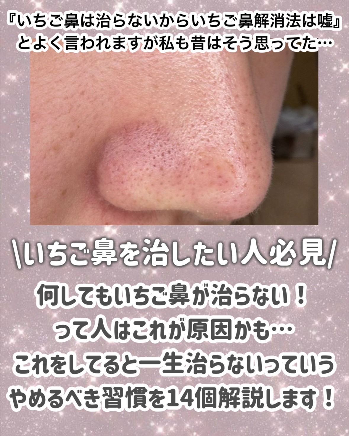 ロゼットゴマージュ/ロゼット/ピーリングを使ったクチコミ（2枚目）