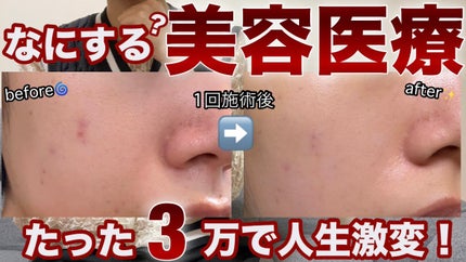 を使ったクチコミ(1枚目)