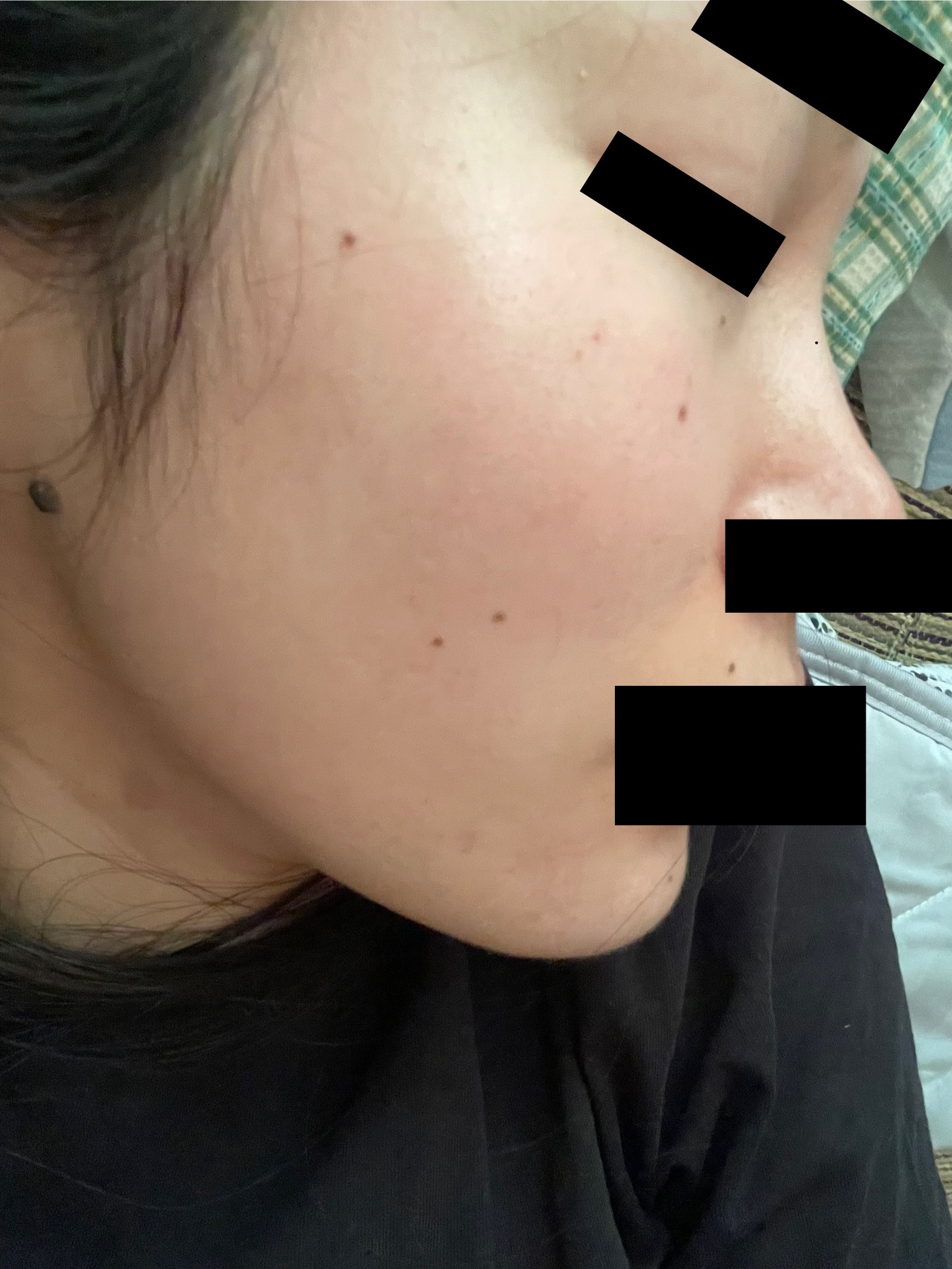 オバジ C25セラム ネオのクチコミ「2025/8/12 久々投稿　29歳の肌
最近肌荒れ酷く、毛穴の開きが気になり始めた。。
前は.....」（2枚目）