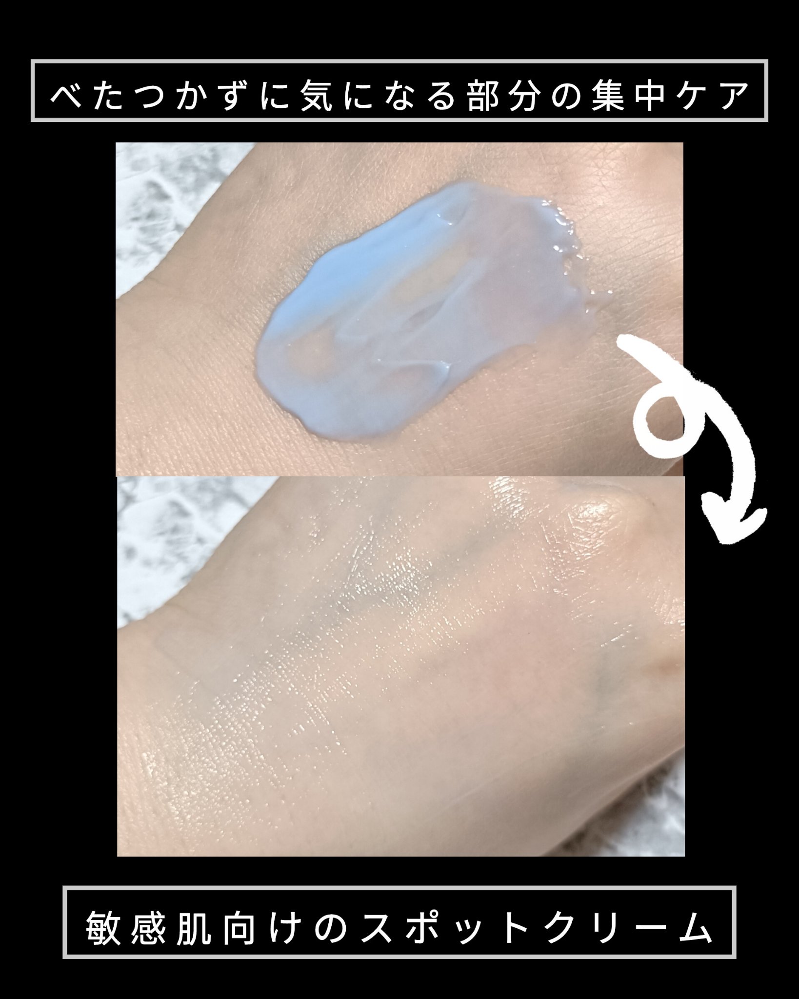 PHセンシティブスポットクリーム/SAM'U/フェイスクリームを使ったクチコミ（2枚目）