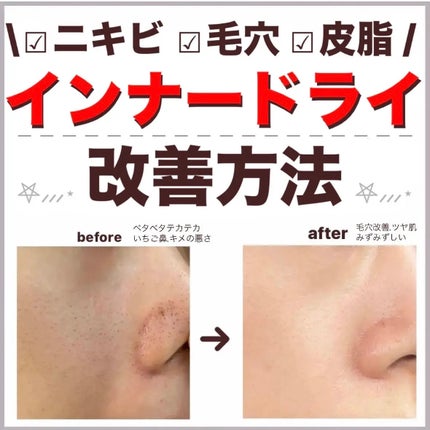 リペア薬用保湿乳液/コラージュ/乳液を使ったクチコミ(1枚目)