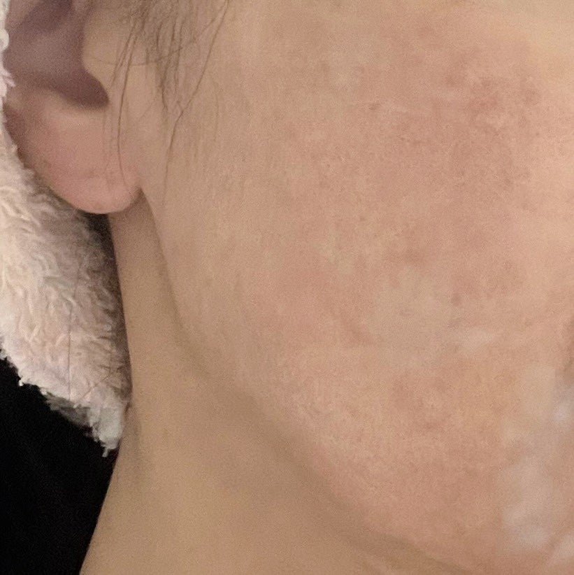 ペプチドボリュームウォーターグローセラム/DR.PEPTI/美容液を使ったクチコミ(8枚目)