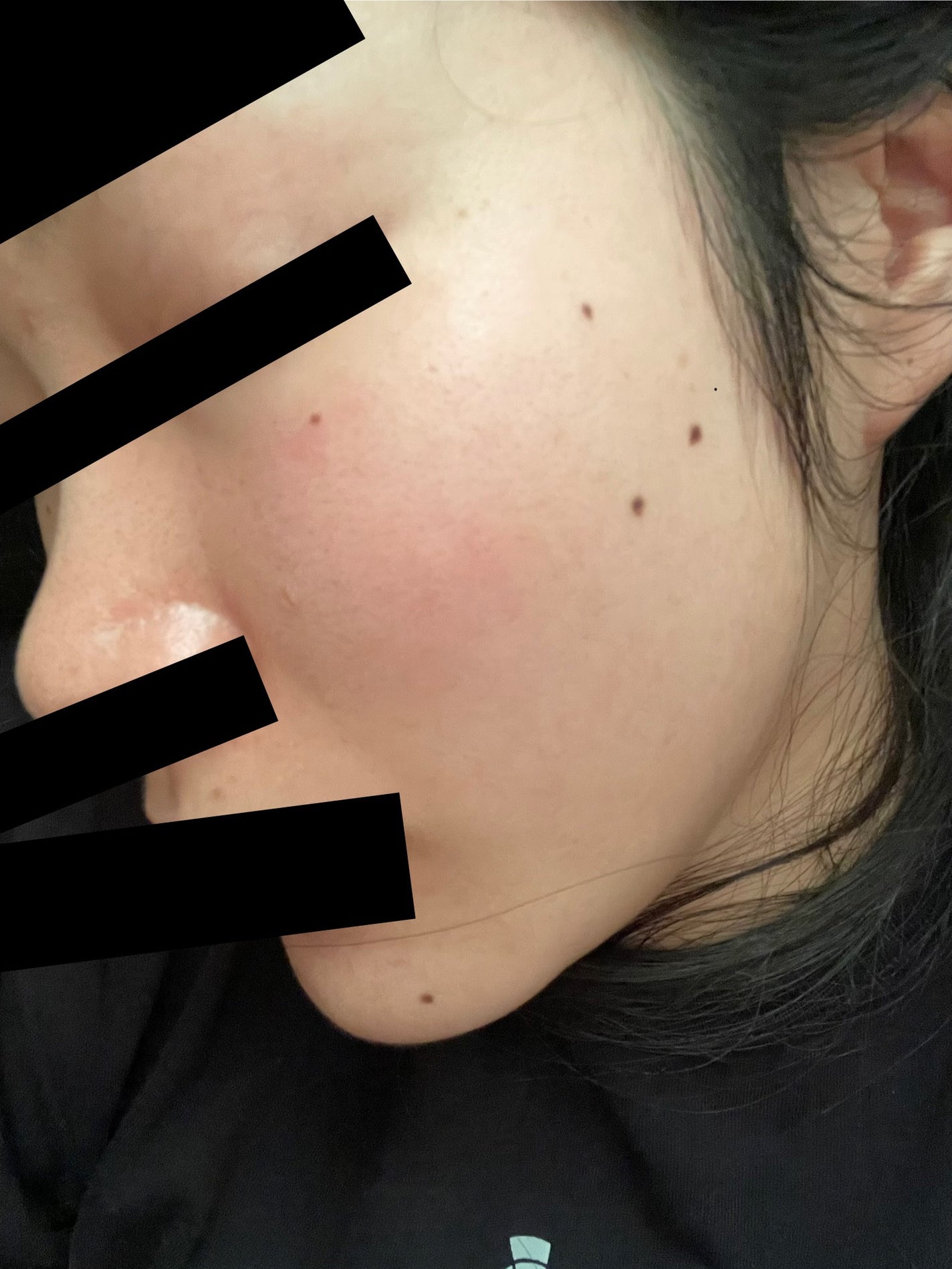 C25セラム ネオ/オバジ/美容液を使ったクチコミ(3枚目)