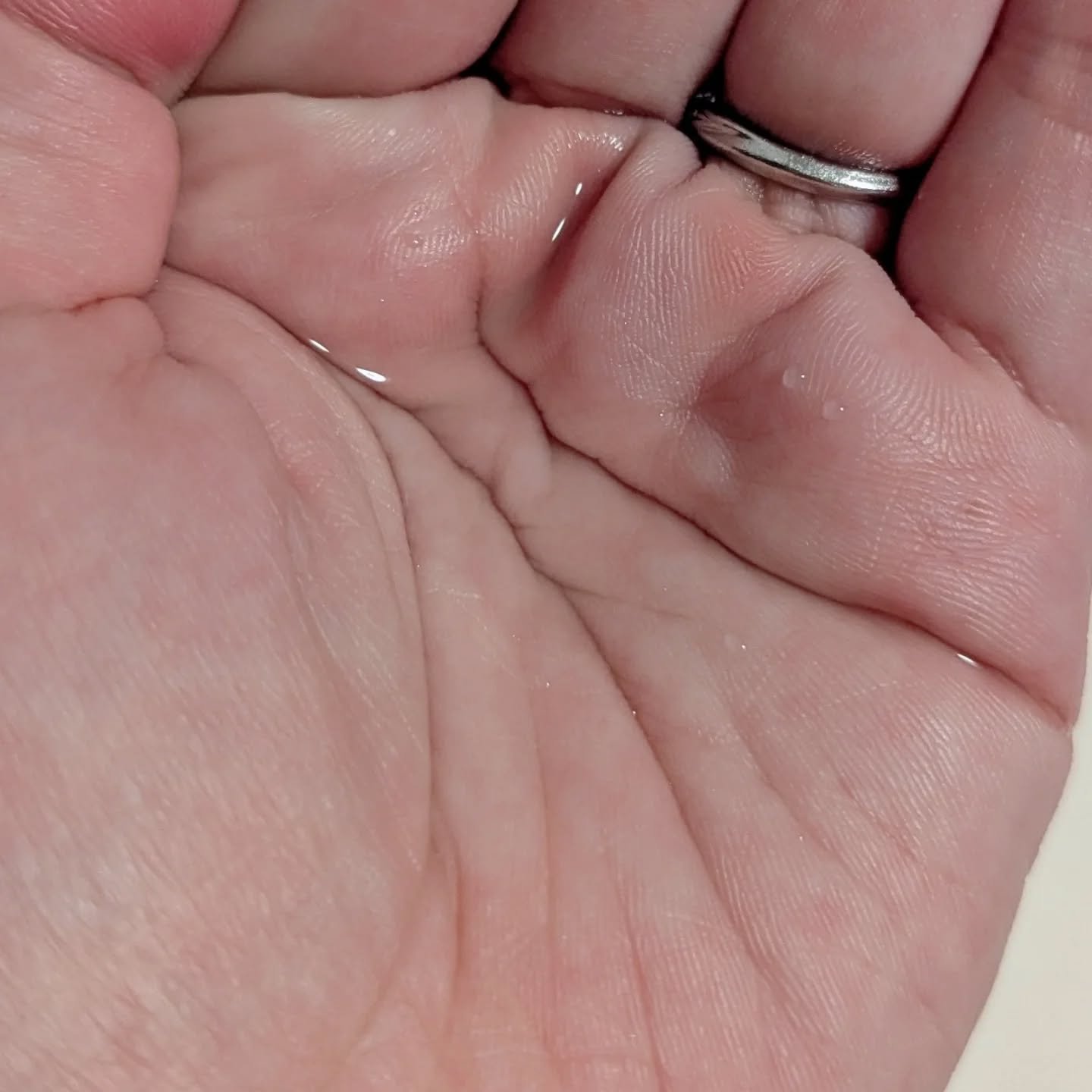 タカミスキンピール/タカミ/ブースター・導入液を使ったクチコミ（3枚目）