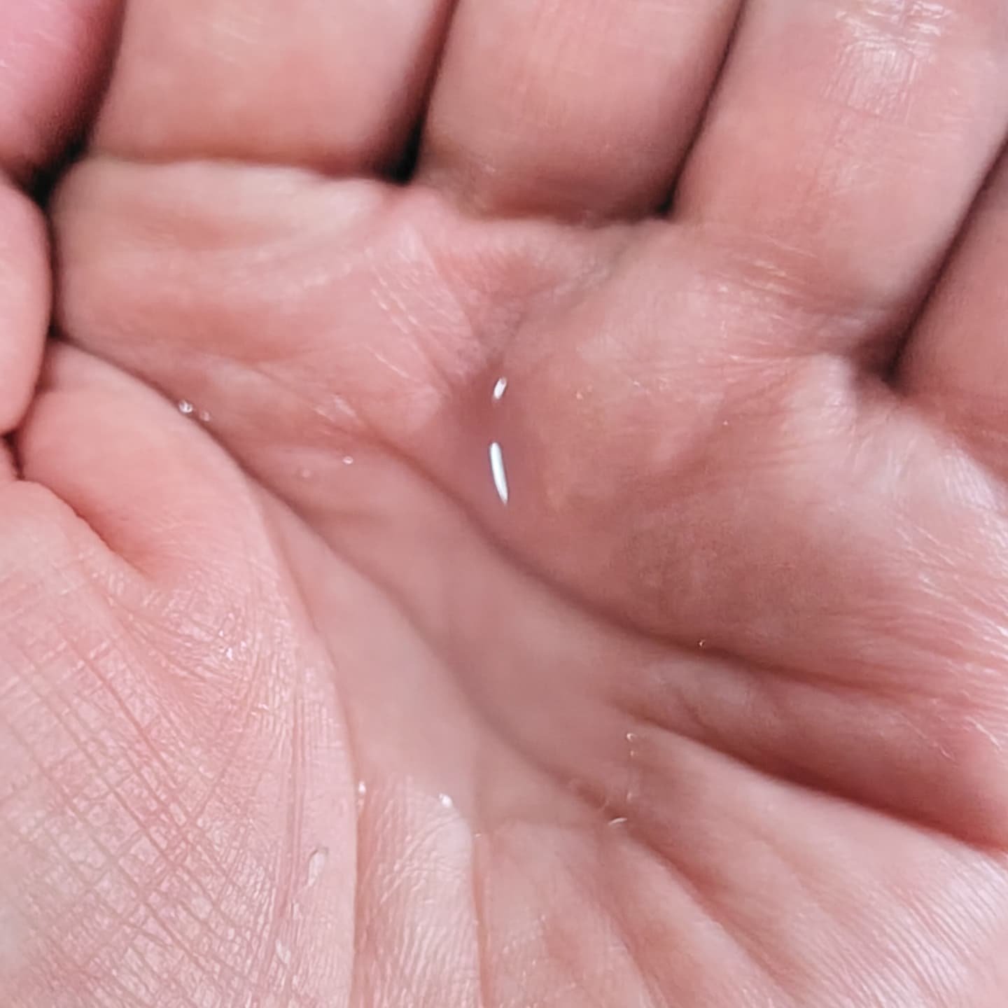 肌美精 CHOI薬用化粧水 ニキビケア[医薬部外品]/肌美精/化粧水を使ったクチコミ（3枚目）