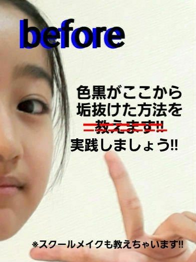 DHC はとむぎエキス/DHC/健康サプリメントを使ったクチコミ(1枚目)