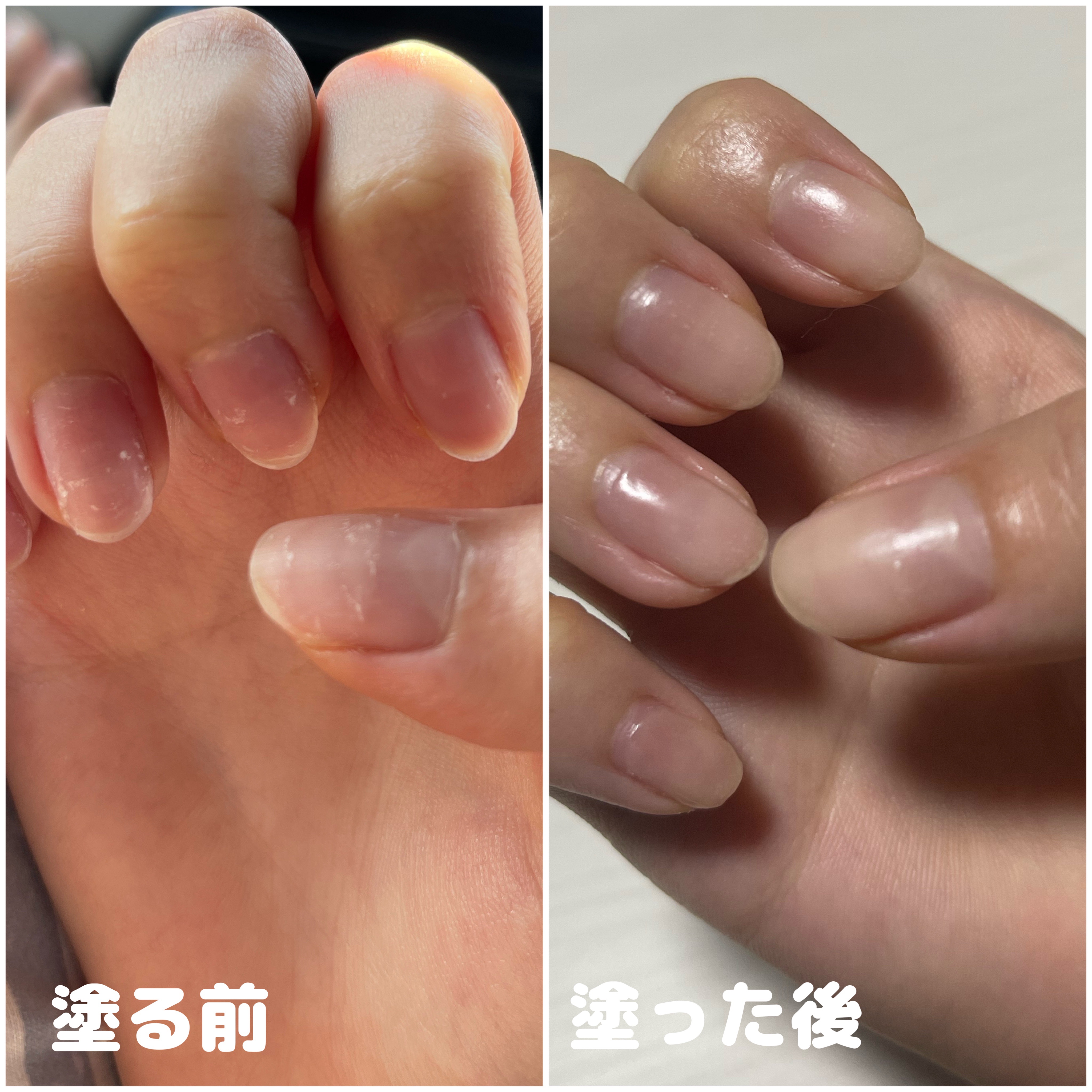 ハンドベール リッチネイル爪補強コート /メンソレータム/オールインワンネイルを使ったクチコミ（2枚目）