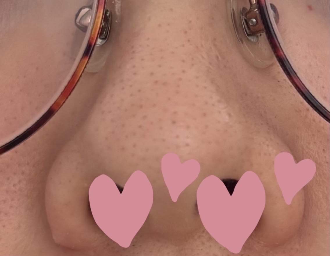 AQ 毛穴美容液オイル/DECORTÉ/フェイスオイルを使ったクチコミ（3枚目）