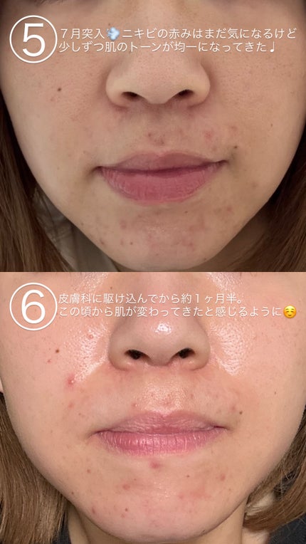 マットシフォン UVホワイトニングベースN/KiSS/化粧下地を使ったクチコミ(3枚目)