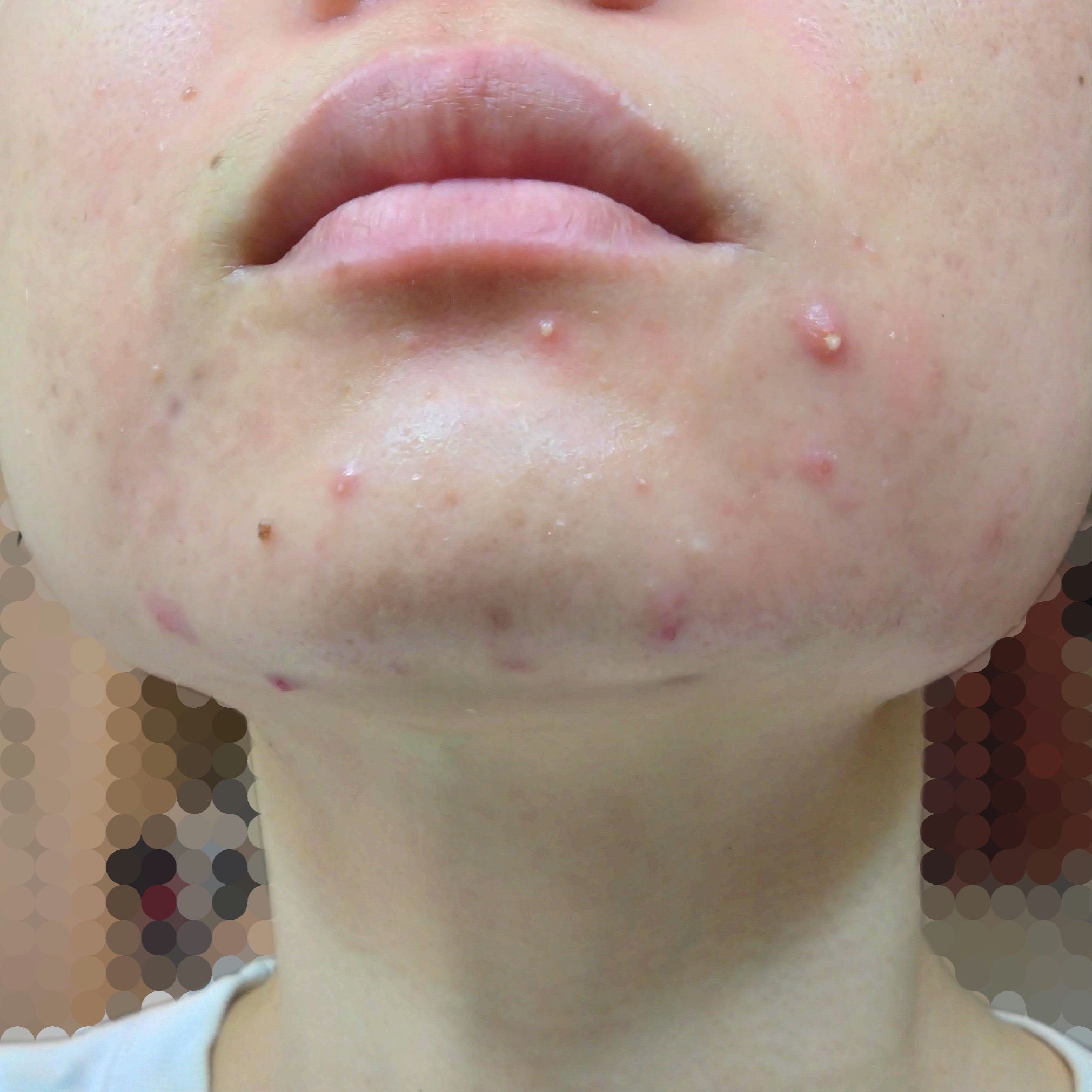 DHC 亜鉛/DHC/健康サプリメントを使ったクチコミ（2枚目）