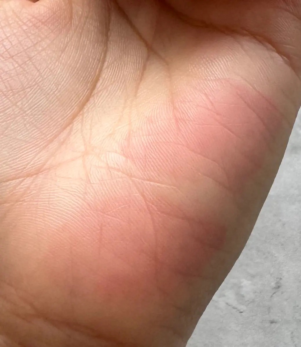 ジューシーデューイグロウティント/dasique/リップティントを使ったクチコミ（3枚目）