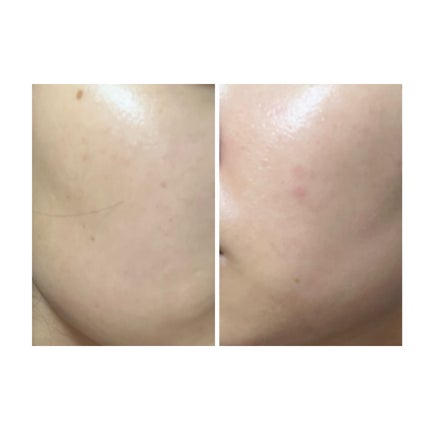 ぽむ on LIPS 「1枚目 2025.8.9エピデュオ 696日目2枚目 2025..」(5枚目)