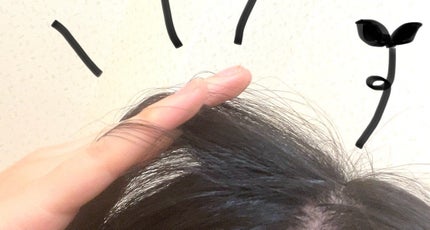 グローターン 100ml/リリーイブ/頭皮ローションを使ったクチコミ(2枚目)