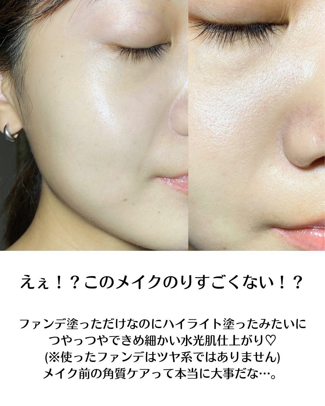 スージングリペア トーニングパッド/ダーマファーム/トナーパッドを使ったクチコミ(6枚目)