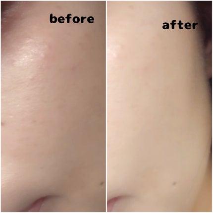 リードルショット300/VT/美容液を使ったクチコミ(4枚目)