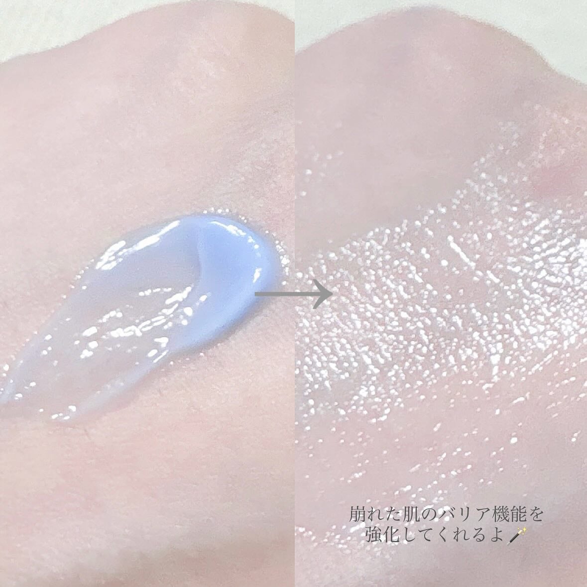 PHセンシティブスポットクリーム/SAM'U/フェイスクリームを使ったクチコミ(3枚目)