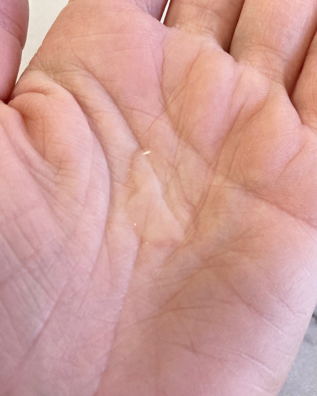 タカミスキンピール/タカミ/ブースター・導入液を使ったクチコミ(4枚目)