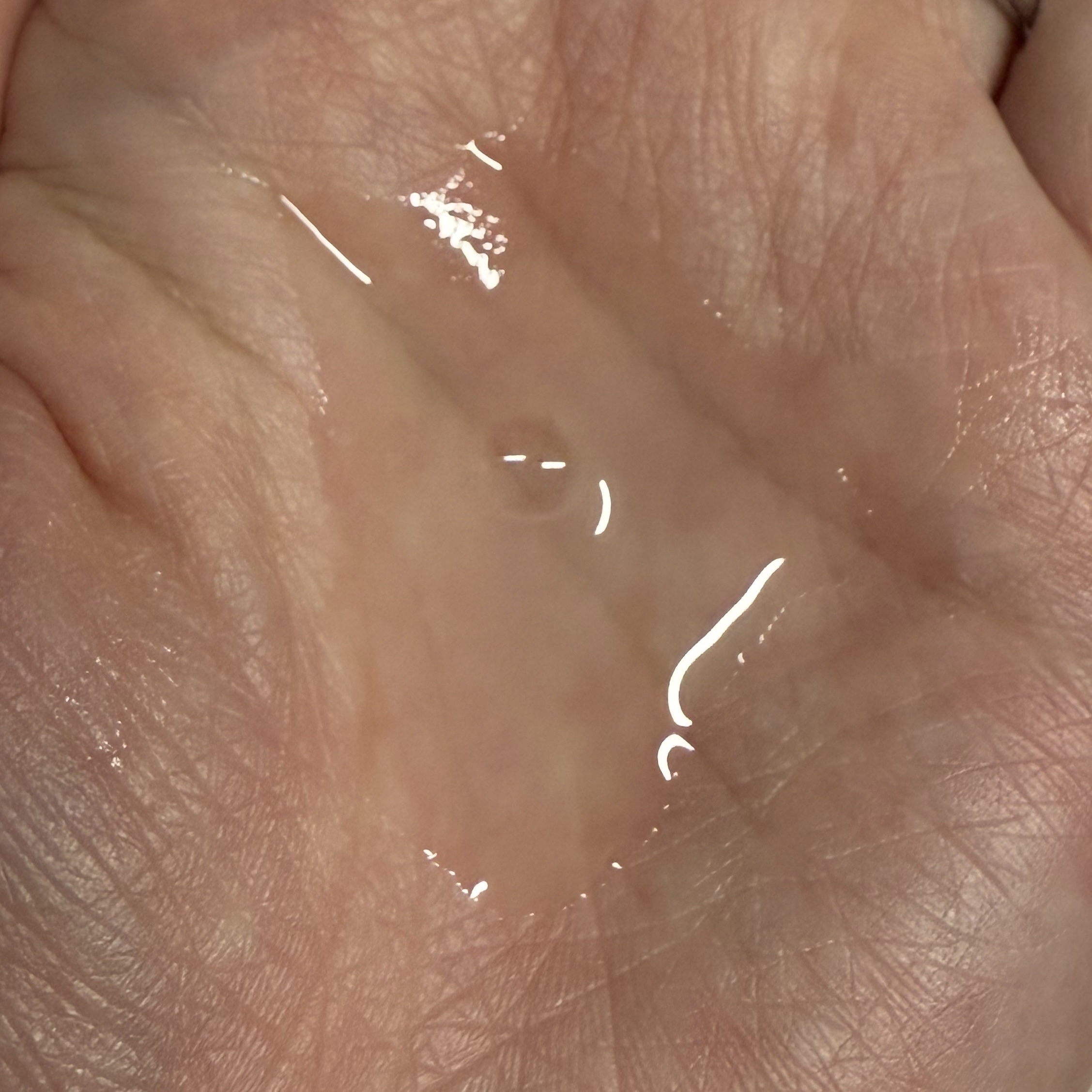 肌美精 CHOI薬用化粧水 ニキビケア[医薬部外品]/肌美精/化粧水を使ったクチコミ（2枚目）